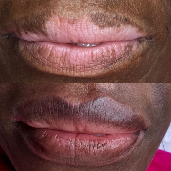 Candy Lips ou Dark Lips