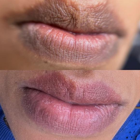 Maquillage permanent des lèvres